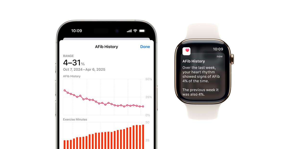 Programvare viser atrieflimmerhistorikk-appen på iPhone og varslinger på Apple Watch.